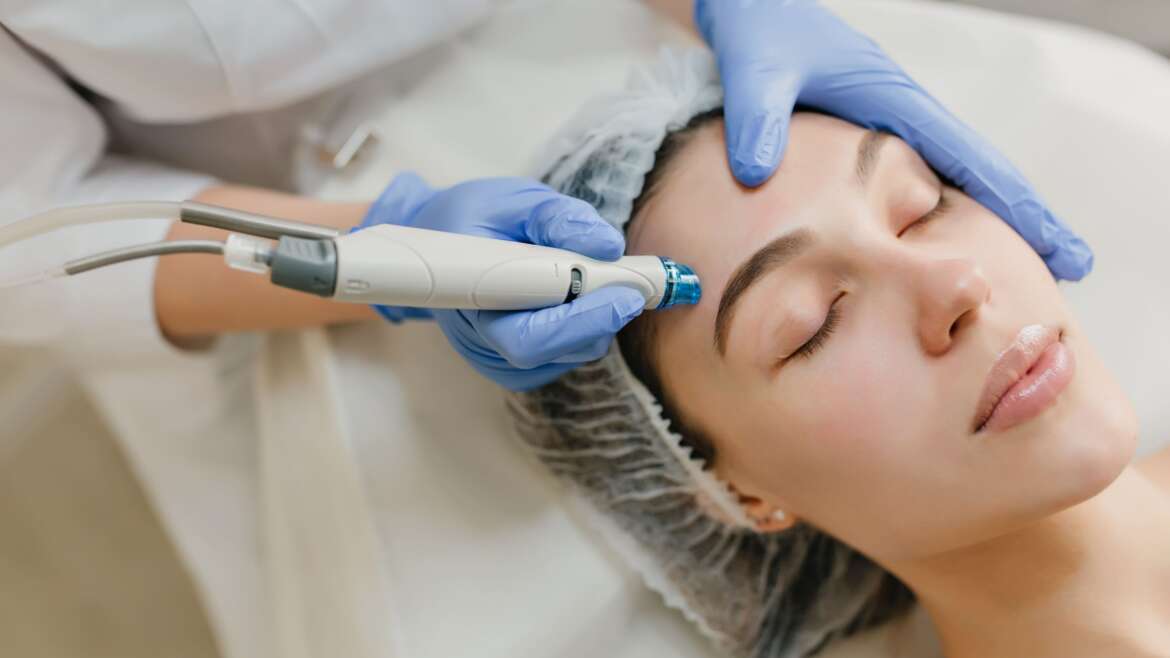 Laser Skin Resurfacing