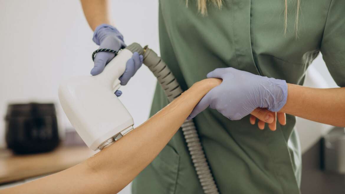 Rosacea Laser Therapy