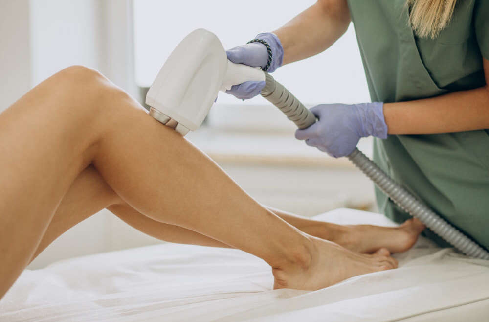 Laser hair removal treatment on a woman’s legs