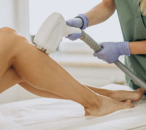 Laser hair removal treatment on a woman’s legs